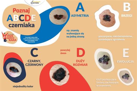  Osteochroma: Nowoczesne Materiały Biokompatybilne dla Impjantów Stawowych?